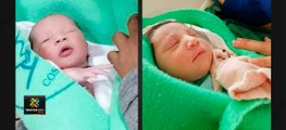 tn7 ya nacieron los primeros gemelos por fecundcion 1201020