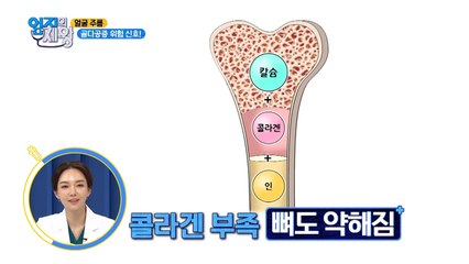 얼굴 주름이 많으면…? "골다공증"이다?!