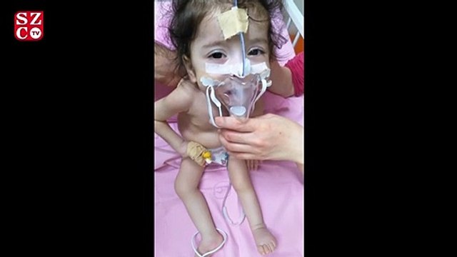 SMA hastası Öykü için yardım kampanyası: Para bulunamazsa 47 gün sonra hayatını kaybedecek