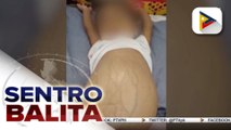 #SentroBalita | Malasakit at Work: Update sa lagay at pagtulong kay Baby Stacy na may biliary atresia