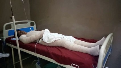 शामली: बिजली की चपेट में आने से पेंटर युवक घायल