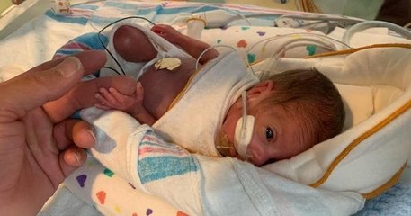 Après 133 jours d'hospitalisation, ce bébé prématuré rentre enfin à la maison