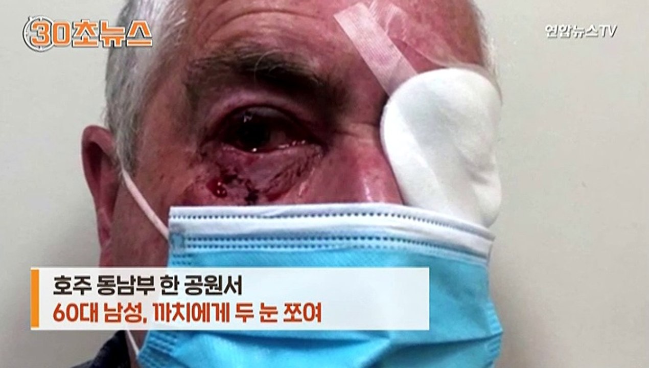 [30초뉴스] 호주 남성, 공원서 점심 먹다가 까치에게 두 눈 쪼여