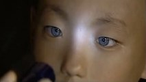 L'histoire incroyable de cet enfant aux yeux de chat qui voit la nuit