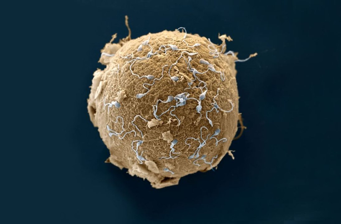 Découverte surprenante : l'ovule choisit les spermatozoïdes qu'il préfère !