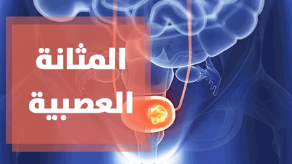 ما هي أسباب الإصابة بالمثانة العصبية؟