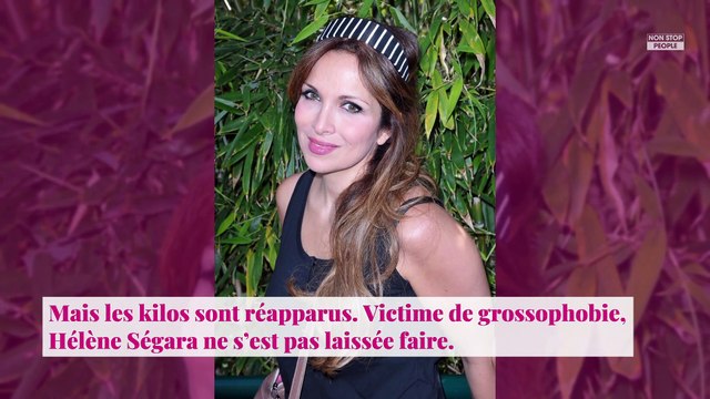 Hélène Ségara amincie et accusée d’avoir fait de la chirurgie esthétique, sa réponse cash !