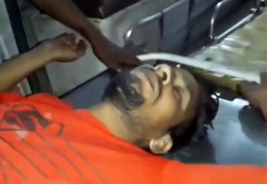 अनियंत्रित होकर सड़क पर गिरी बाइक युवक हुआ घायल