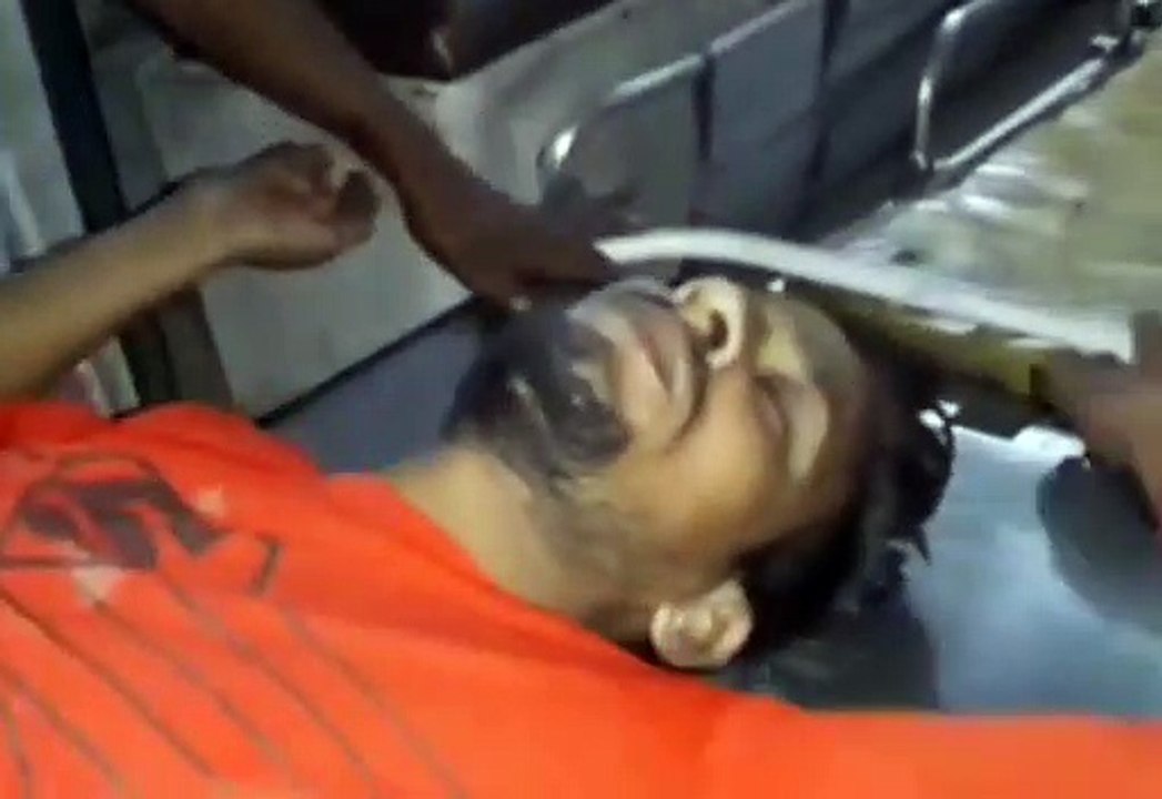 अनियंत्रित होकर सड़क पर गिरी बाइक युवक हुआ घायल