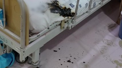 경북 김천 종합병원서 흉기 휘두르고 불 질러...2명 부상·3명 화상 / YTN