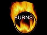 Burns Burns Ring of Fire