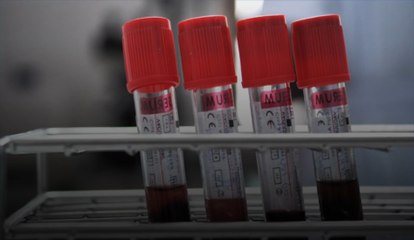 Le groupe sanguin peut affecter le risque et la gravité du coronavirus