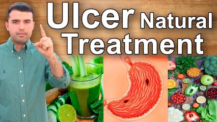 Ulcer Best Treatment | Health Tips