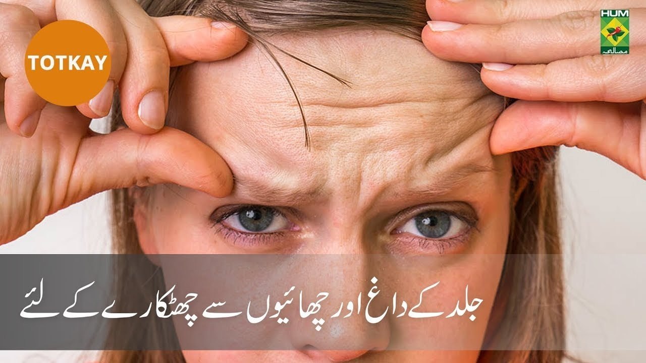 Jild Kay Dagh Or Chaion Se Chutkare K Liye | Totkay | Zubaida Appa | Health Tips
