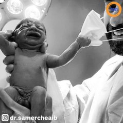 La photo de ce nouveau-né fait le tour du monde pour une raison surprenante !