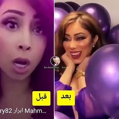 أول ظهور لأبرار الكويتية بعد عملية تجميل أنفها