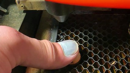 Hématome sous un ongle vs Découpeur laser