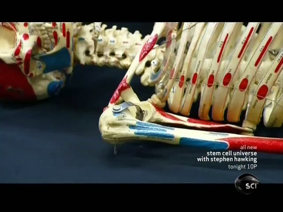 How Its Made - 543 Artificial Joints 2