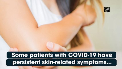 Some Covid-19 'long haulers' experience lasting skin problems