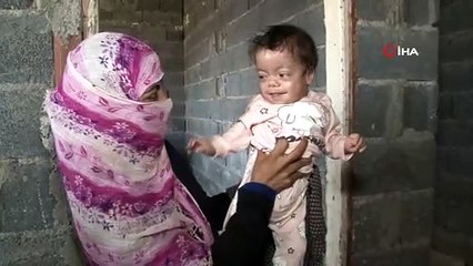 Balık Pulu Hastası Kardeşler Yardım Bekliyor