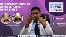 Advantages of Rhinoplasty Surgery, Rhinoplasty (Nose Job Surgery Delhi)