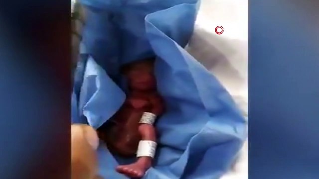 - Meksika’da öldü denilerek morga kaldırılan bebeğin yaşadığı ortaya çıktı