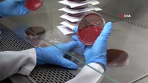 Uzun Süre Kullanılan Maskedeki Bakteriler Laboratuvarda Gözler Önüne Serildi