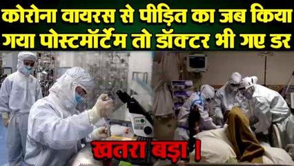 CORONA VIRUS को लेकर बड़ा खतरा, मरने के बाद भी इतने घंटो तक फैलता रहता है कोरोना वायरस, उड़ेंगे आपके..