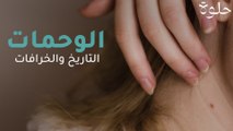 الوحمات: التاريخ والخرافات