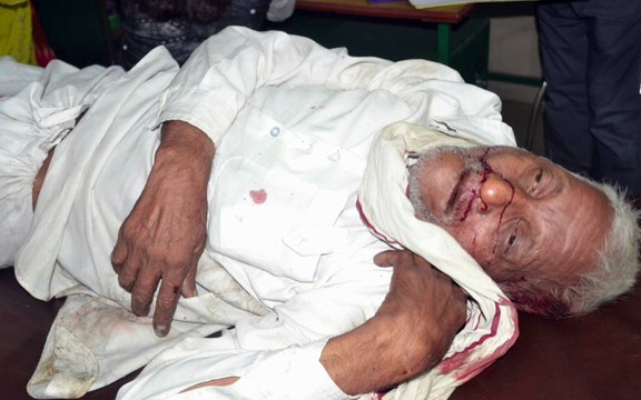 शामली: बाइक व टेंपो की एक की मौत आधा दर्जन घायल