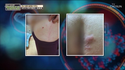 온갖 염증 질환 이유.. 몸 속 ˹이것˼ 때문 #광고포함