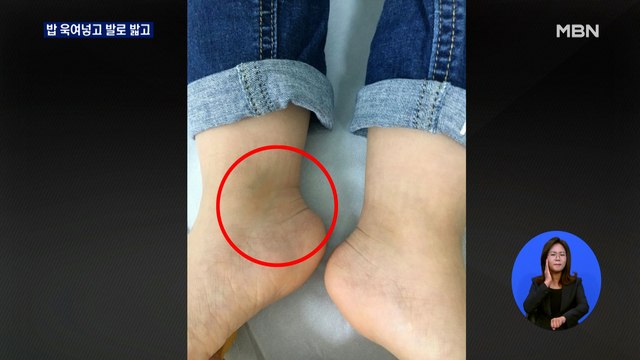 밥 욱여넣고 발로 밟고… 학대 피해 아동 3명 더 있다