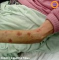 Âgée de 90 ans, elle a été battue par une autre résidente du foyer de soins