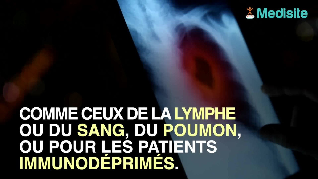 Cancer et Covid : ce que vous risquez