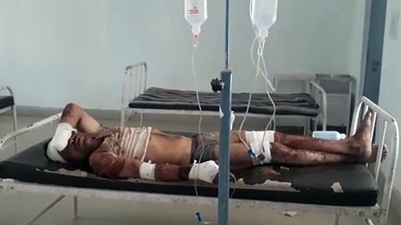 दो भाई ने मिलकर सगे भाई  का काट दिया हाथ