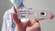 United Airlines To Offer Free COVID-19 Tests For Passengers