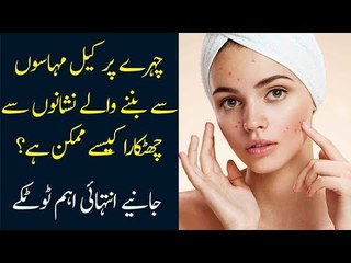 How to Get Rid of Pimples from Face? Find Out Easiest Method in this Video
