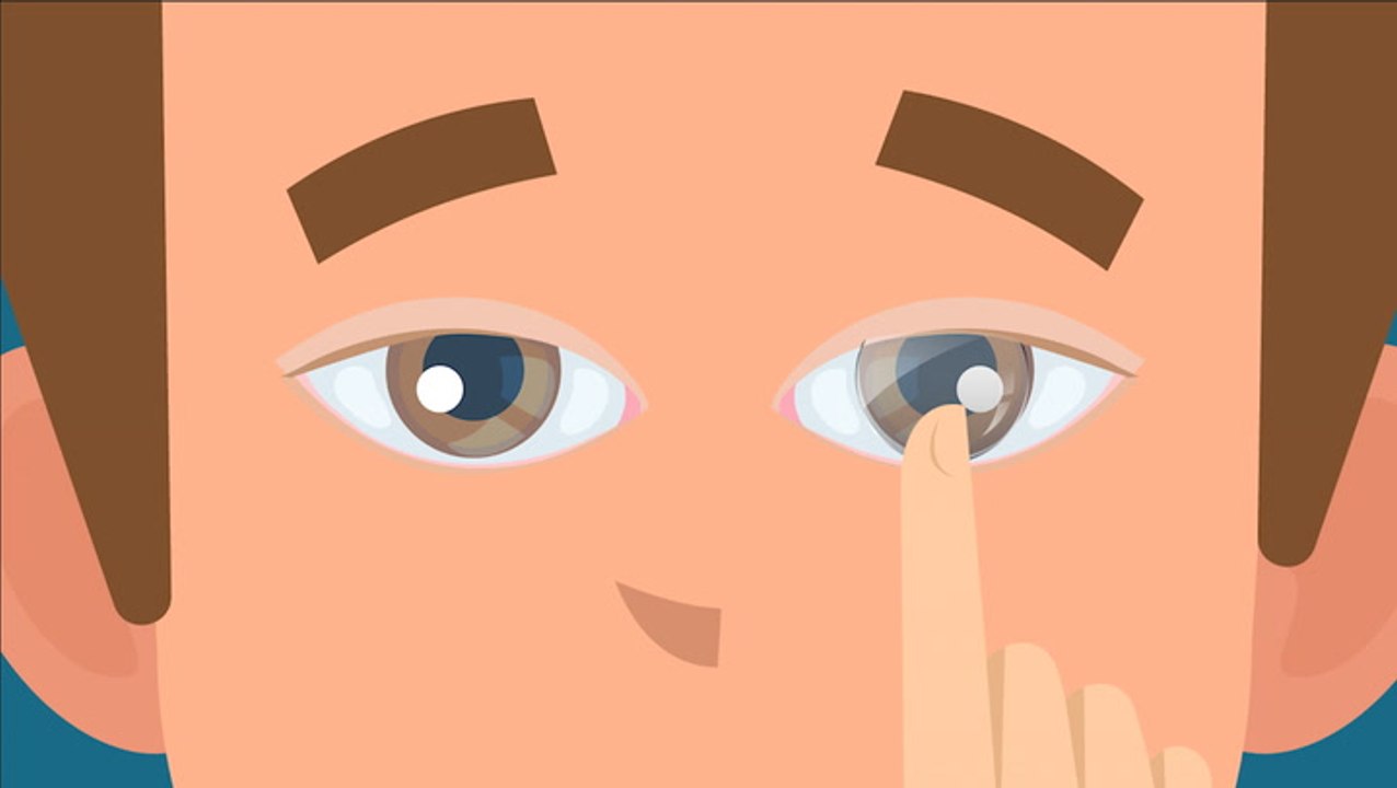 What happens when you sleep in your contacts