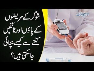 How To Save Diabetics From Foot & Leg Amputations? | Watch Interview With An Expert Surgeon