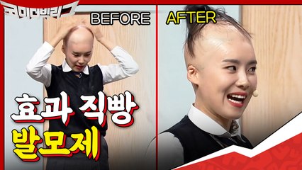 아 두피 타기 전에 선크림 발라야 하는데.. 그냥 발모제를 발라야겠다! 자라나라 모리모리☆