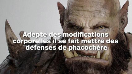 Il se fait mettre des dents de phacochère dans la bouche