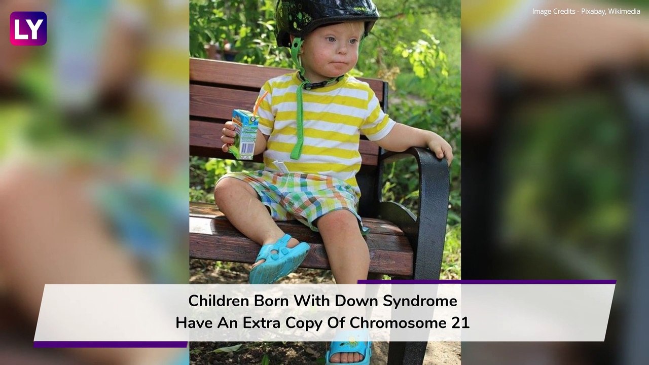 World Down Syndrome Day 2020: How To Care For A Newborn With Down Syndrome Disease?