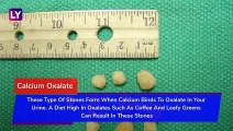 Different Types Of Kidney Stones And How To Prevent Them: World Kidney Day 2020