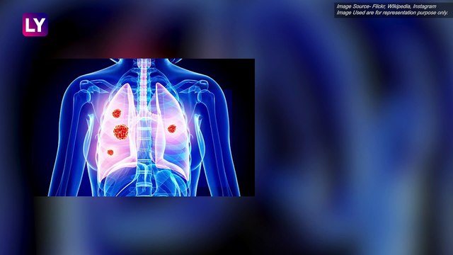 Delhi Air Pollution: Ways to Prevent Further Lung Damage And Reduce Cancer Risk