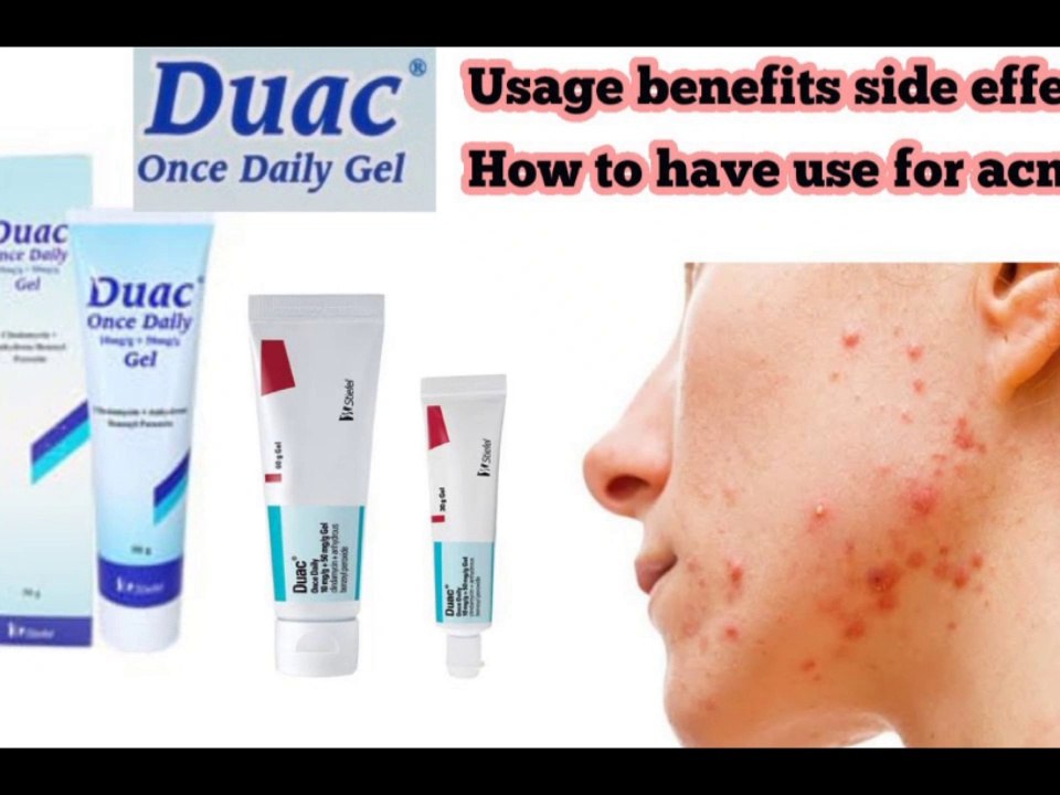 Duac Once Daily Gel Best treatment for acne and pimples video