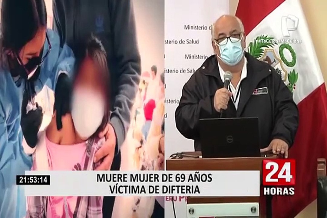 Difteria en Perú: establecen alerta epidemiológica tras segunda muerte por la enfermedad