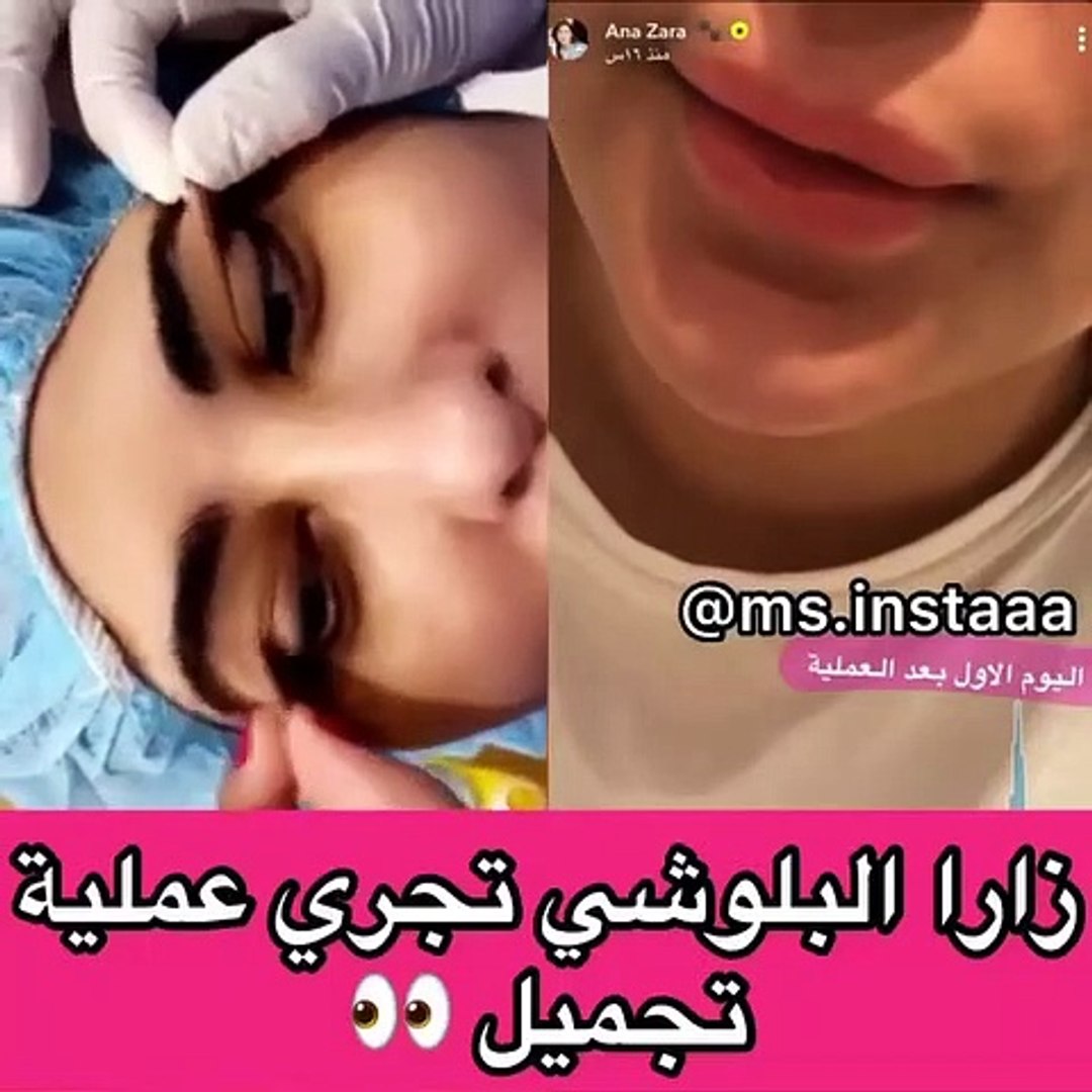 Ø²Ø§Ø±Ø§ Ø§Ù„Ø¨Ù„ÙˆØ´ÙŠ ØªØ®Ø¶Ø¹ Ù„Ø¹Ù…Ù„ÙŠØ© ØªØ¬Ù…ÙŠÙ„ Ø¬Ø¯ÙŠØ¯Ø© ÙˆØªÙØ§Ø¬Ø¦ Ù…ØªØ§Ø¨Ø¹ÙŠÙ‡Ø§ Ø¨Ø§Ù„Ù†ØªØ§Ø¦Ø¬ ÙÙŠØ¯ÙŠÙˆ Dailymotion