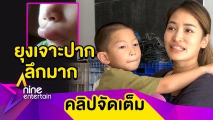 “พลอยพรรณ” ตกใจ! “น้องพูม่า” โดนยุงกัดปากบวม ลูกชายเผยเกือบเป็นลมเมื่อเห็นปากตัวเอง (คลิปจัดเต็ม)
