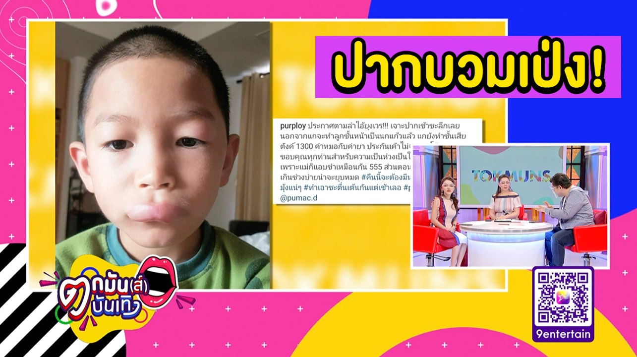 "พลอย" เฉลย "น้องพูม่า" ปากบวมเพราะถูกยุงกัด l...