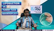 Fat Removal Surgery _ Liposuction Vs. Tummy Tuck _ Best Fat Removal Surgery in Delhi _Cosmetic Surgeon Dr. PK Talwar
